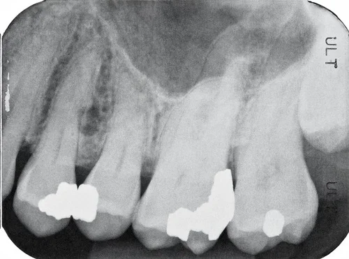 Sinus_1.jpg