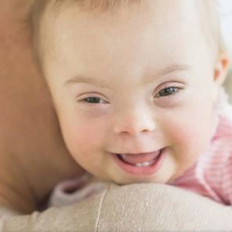 Down Syndrome Awareness