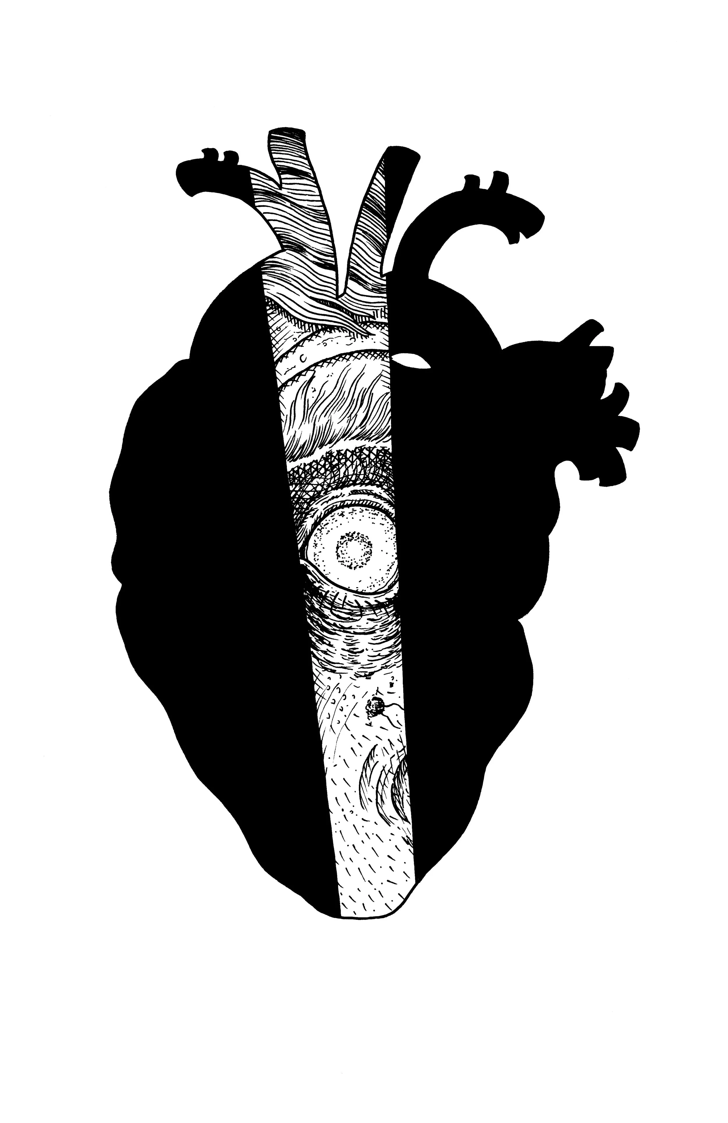 The Tell Tale Heart