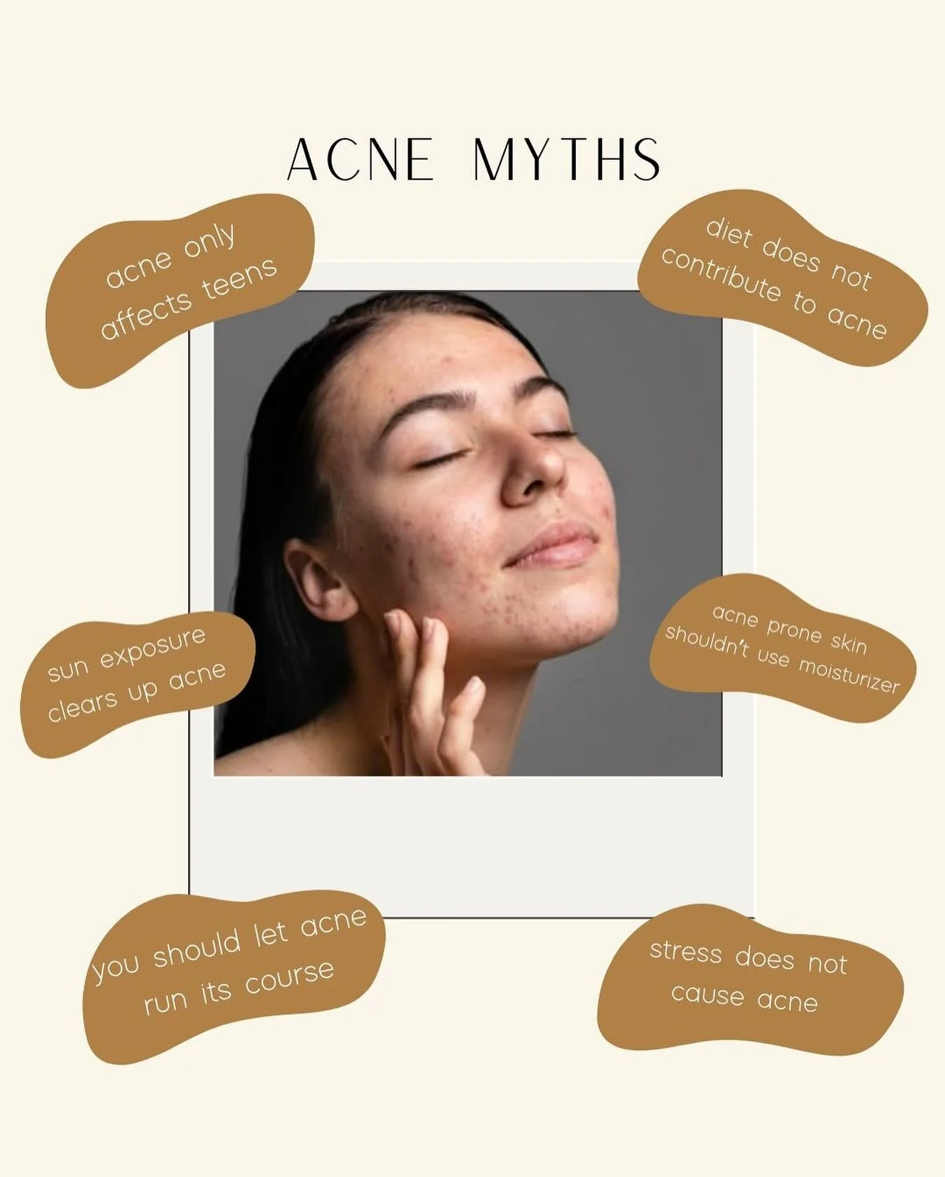 6 Acne Myths: Don&rsquo;t Fall For Them!
Don&rsquo;t let myths sabotage your journey to clear, healthy skin.

Ready to stop guessing and start seeing real results? I can teach you the facts and create a personalized routine that truly works.
✨ Tap th