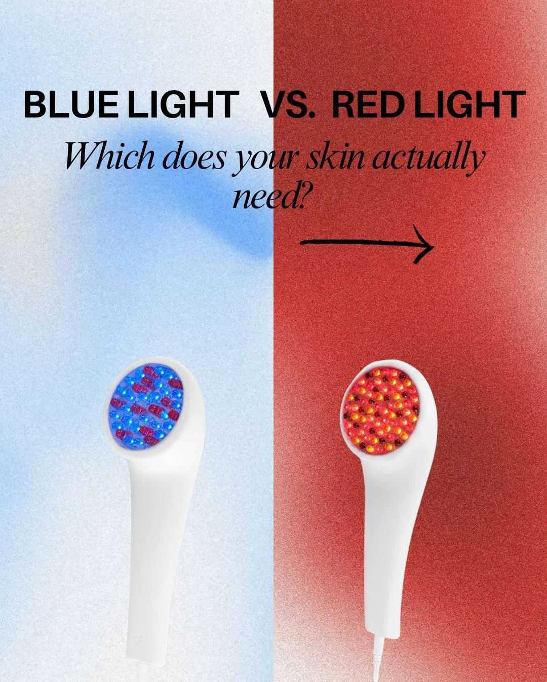 Stop guessing and start glowing. ✨ Is your skin craving Blue or Red light?

If you can&rsquo;t decide which color your skin needs, here is your cheat sheet:

🟦 TEAM BLUE: Best if you are currently fighting active breakouts. It stays on the surface (