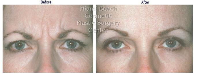 Miami Beach Plastic And Cosmetic Surgery By Dr Baruch Jacobs Miami Beach Plastic And Cosmetic Surgery By Dr Baruch Jacobs