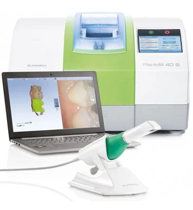 Digital Intraoral Scan and CAD CAM (1 Day Crown)