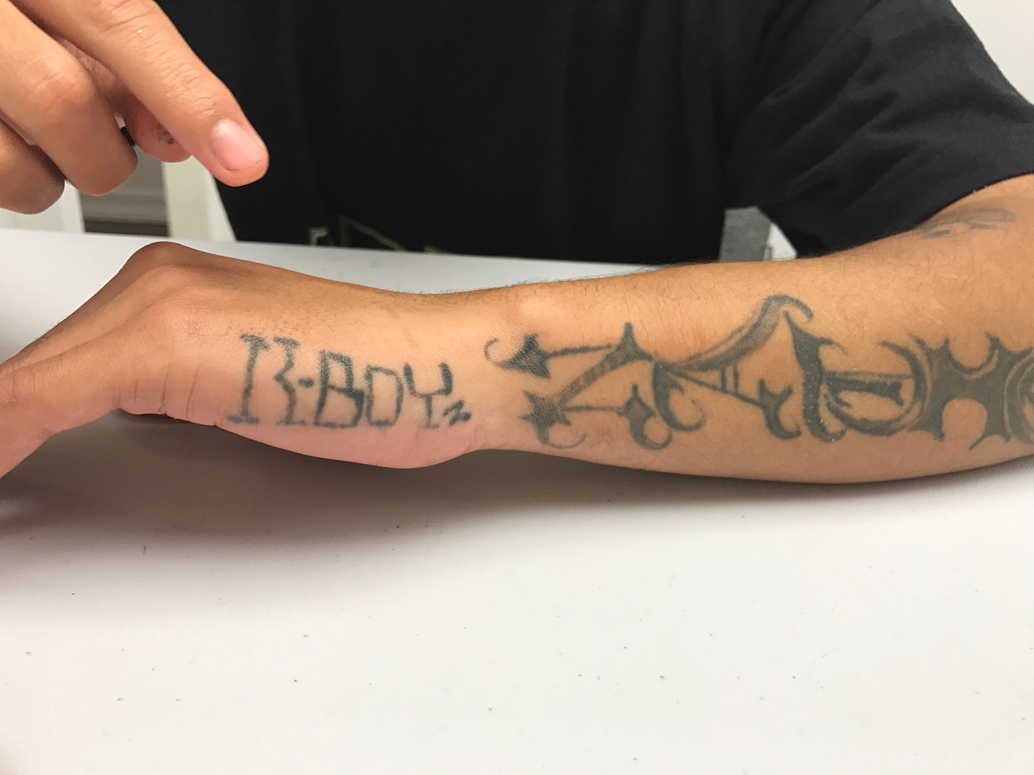 North County Tattoo Removal Program — COMPACT