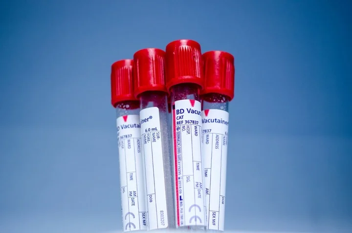 group-technology-tube-red-equipment-human-977887-pxhere.com.jpg