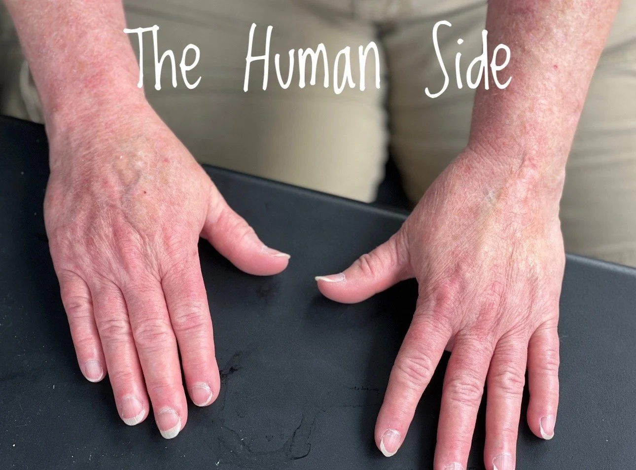 The Human Side