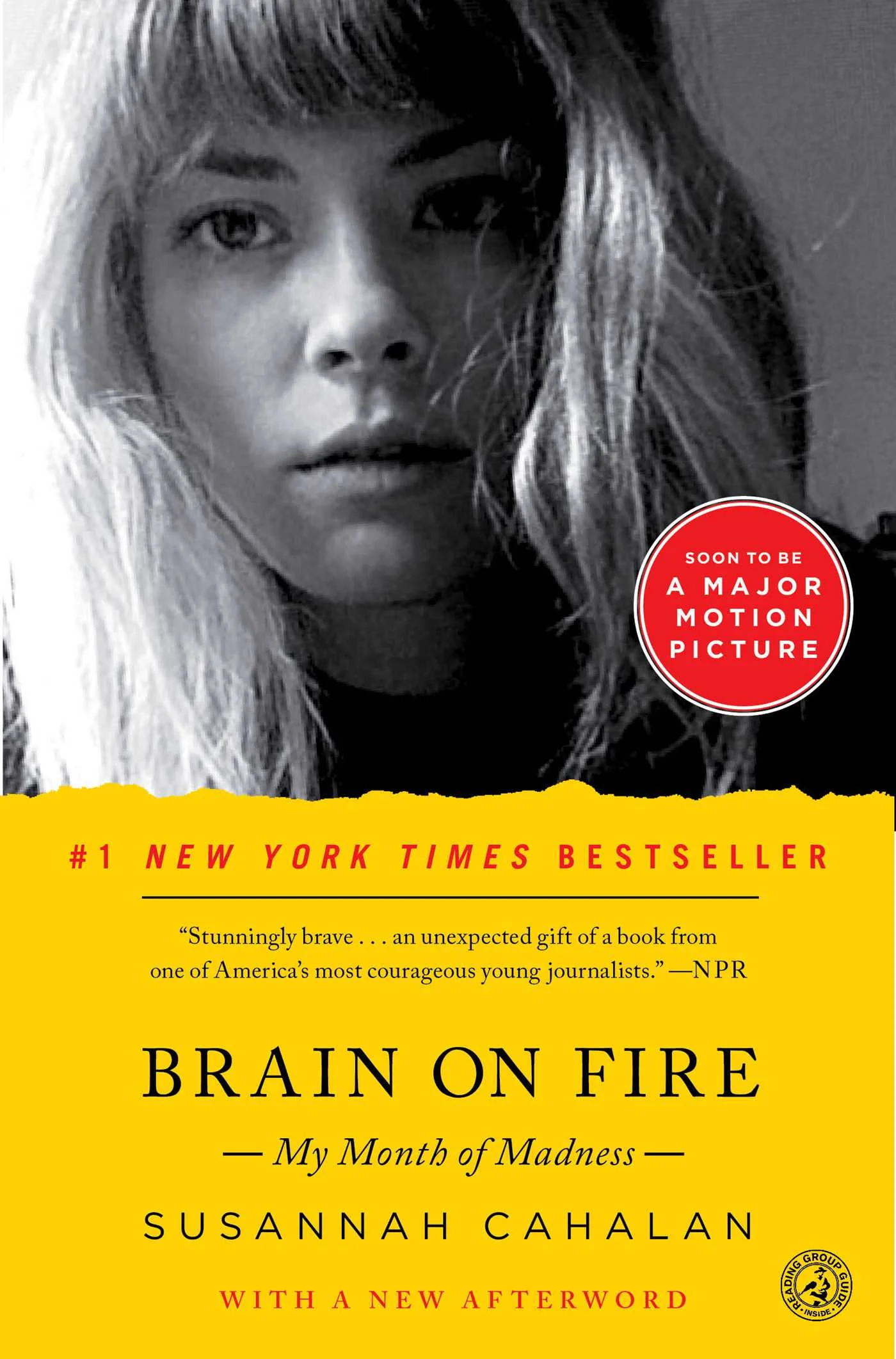 brain on fire.jpg