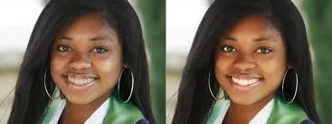 Combat Acne With 5 Astonishing Egg White Tips For A Smooth And Irresistible Skin