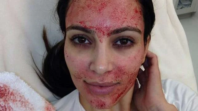 Did you know you can use your own blood for a facial?