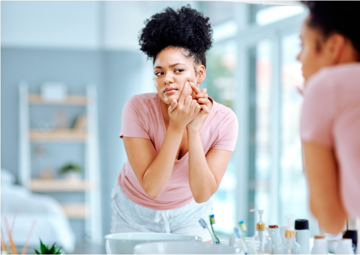 Dealing With Stress Acne; Your Guide To Treating It