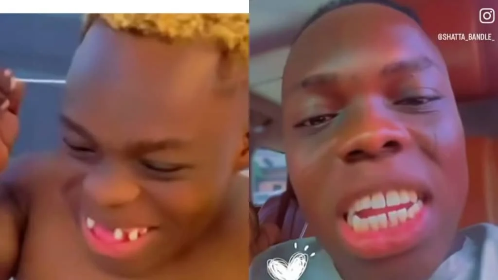 Shatta Bandle loses part of newly fixed teeth weeks after flaunting new set