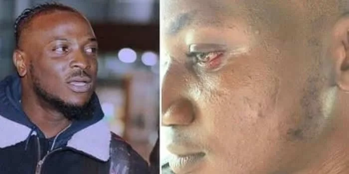 "Peruzzi Warns Influencer Pamilerin Not to Drag Him Over Their 2019 Fight: 'Slaps Expire After 3 Years'"