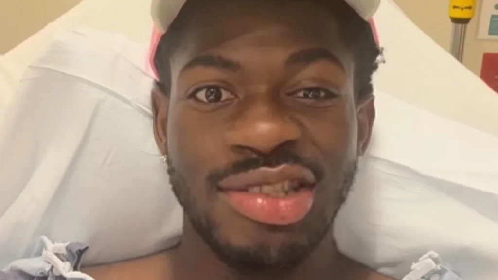 Lil Nas X Reveals Partial Facial Paralysis: “I Can’t Even Laugh Right”