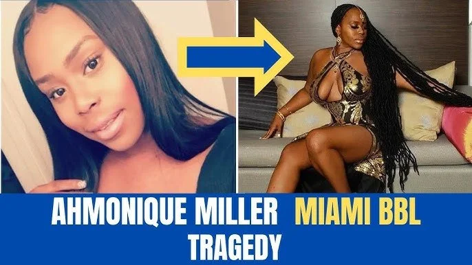 Tragedy After BBL: 28-Year-Old Ahmonique Miller Dies in Miami Hours After Surgery