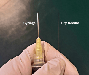 dry needling needle size.png