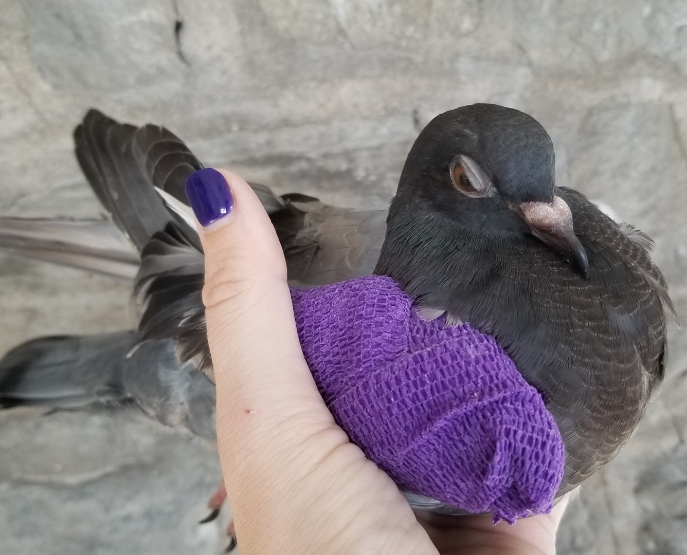 This pigeon had a fractured wing, seen here in a stabilizing “figure 8” wing wrap