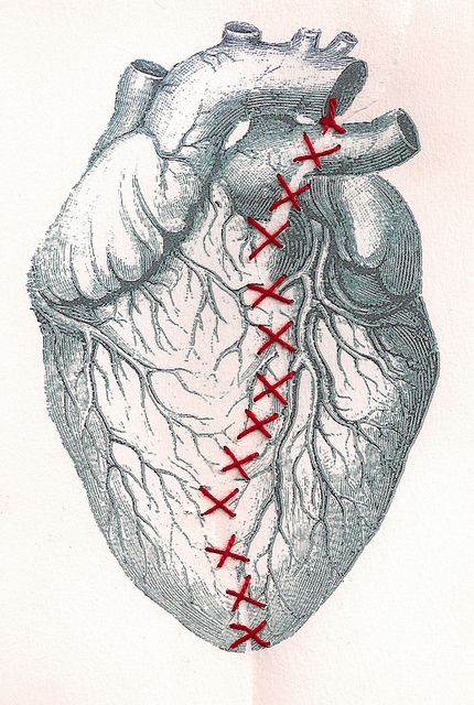 Broken Heart - Unknown