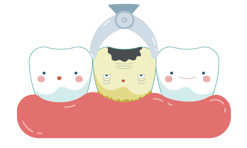 dental-extractions-in-sudbury.png