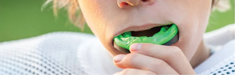 custom-mouthguards-in-sudbury.jpg