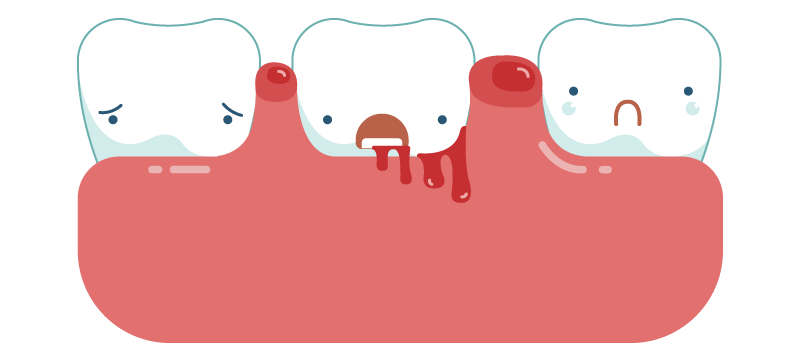 gum-health-in-sudbury.png