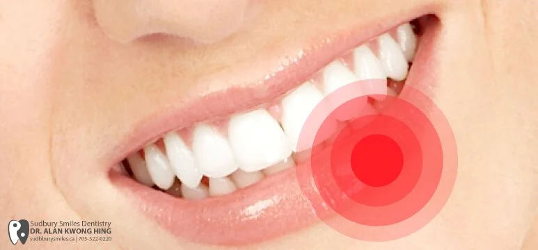 How To Treat Cold Sores Sudbury Smiles Dentistry