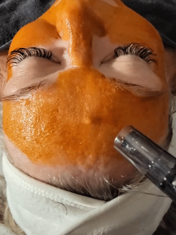 ezgif.com-gif-maker (1).gif