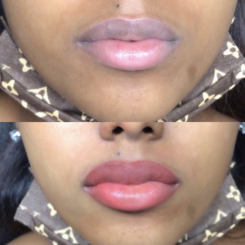 Permanent Lip Color Healing Process: Everything You Need to Know