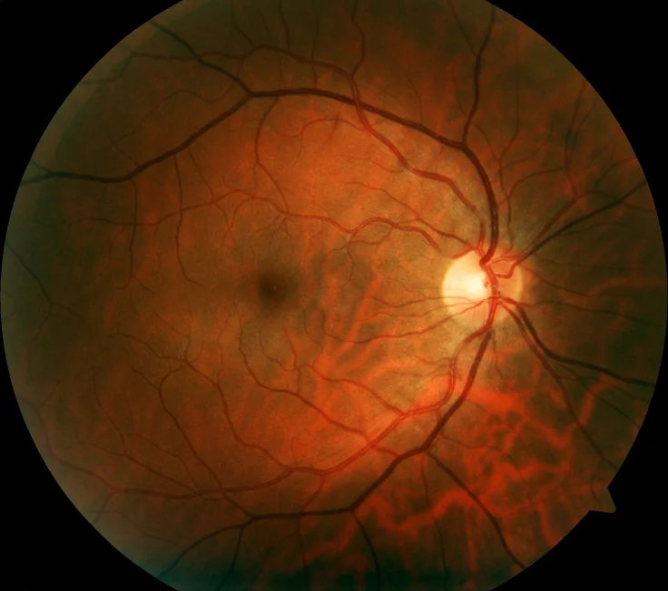 iStockEyehealthpage.jpg
