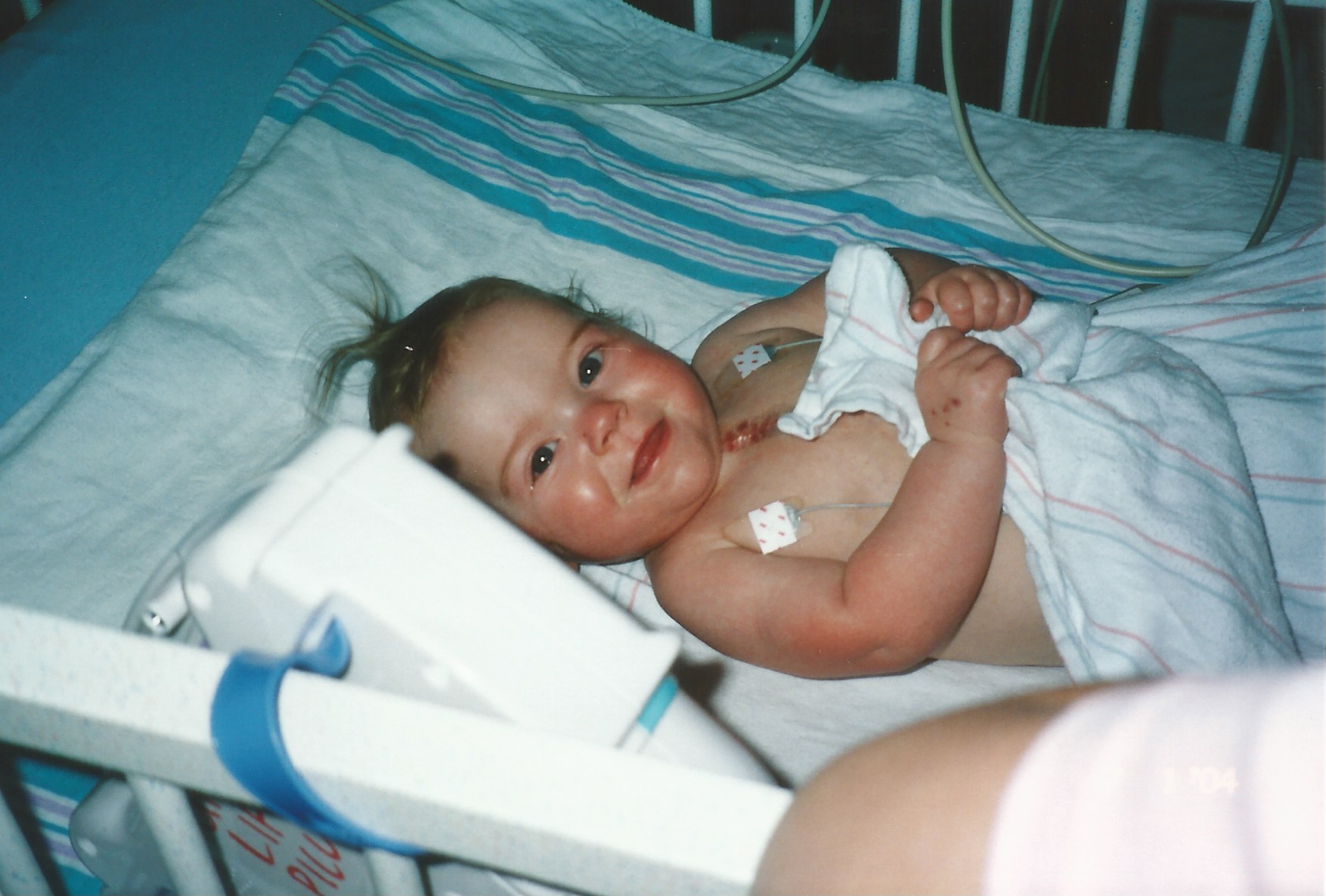 A very happy (and strong) Kenedee after open heart surgery.