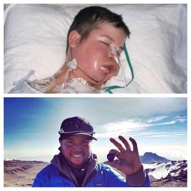 Top: After one of Mike’s 75 surgeries. Bottom: Mike atop Mount Kilimanjaro.