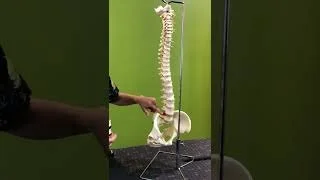 What is a disc bulge?