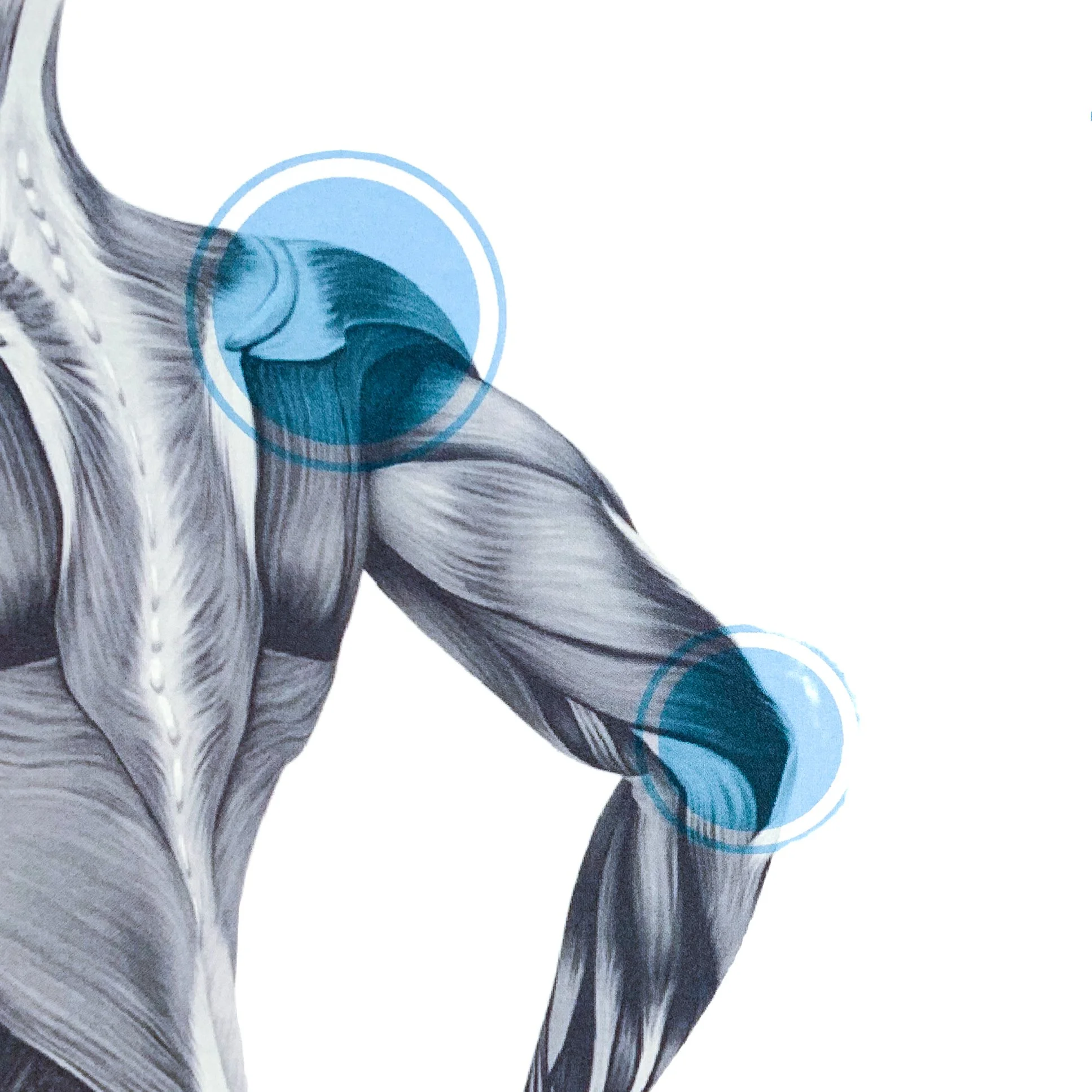 Trigger Point Therapy