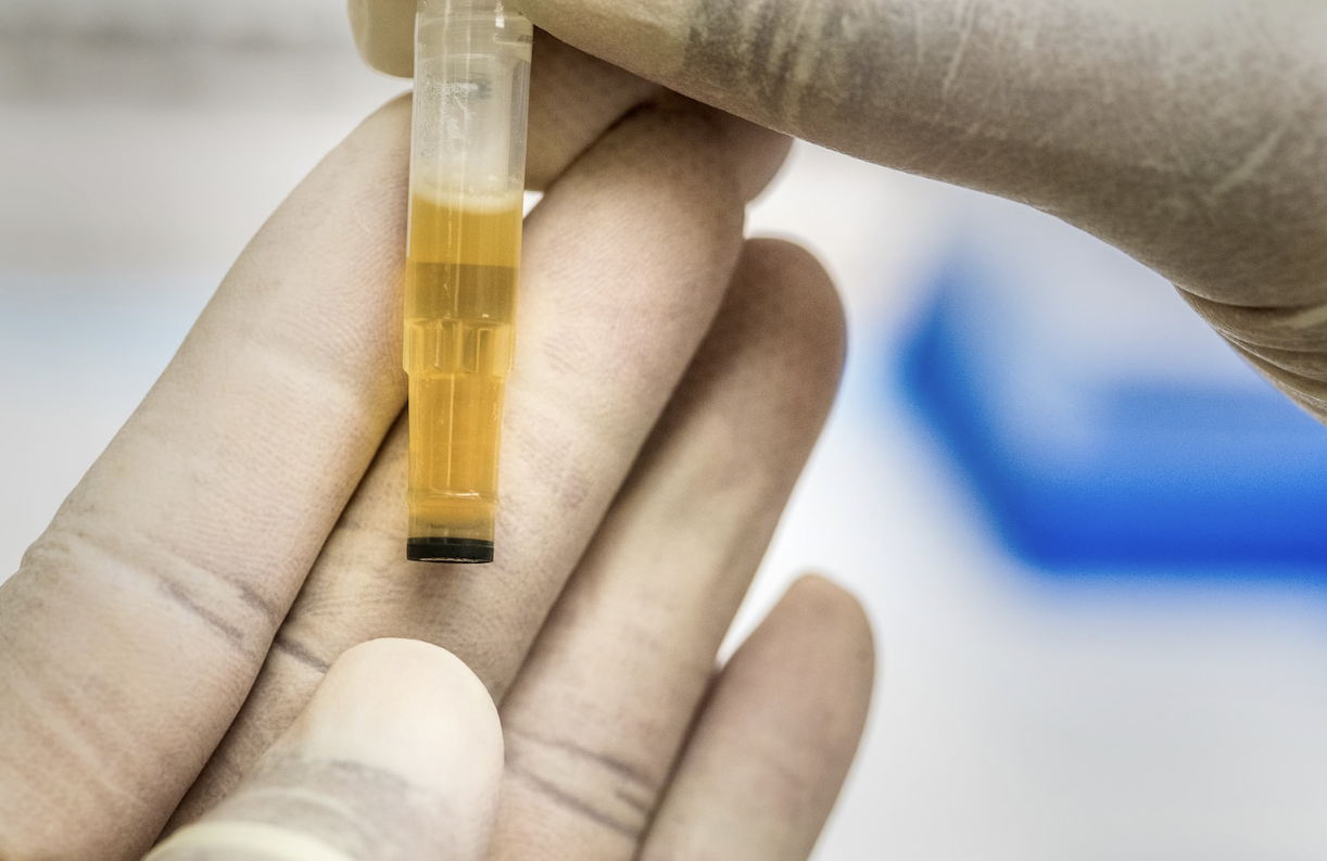 Leading the Pack: A Comprehensive Review of the Top 3 Synthetic Urine Brands on the Market