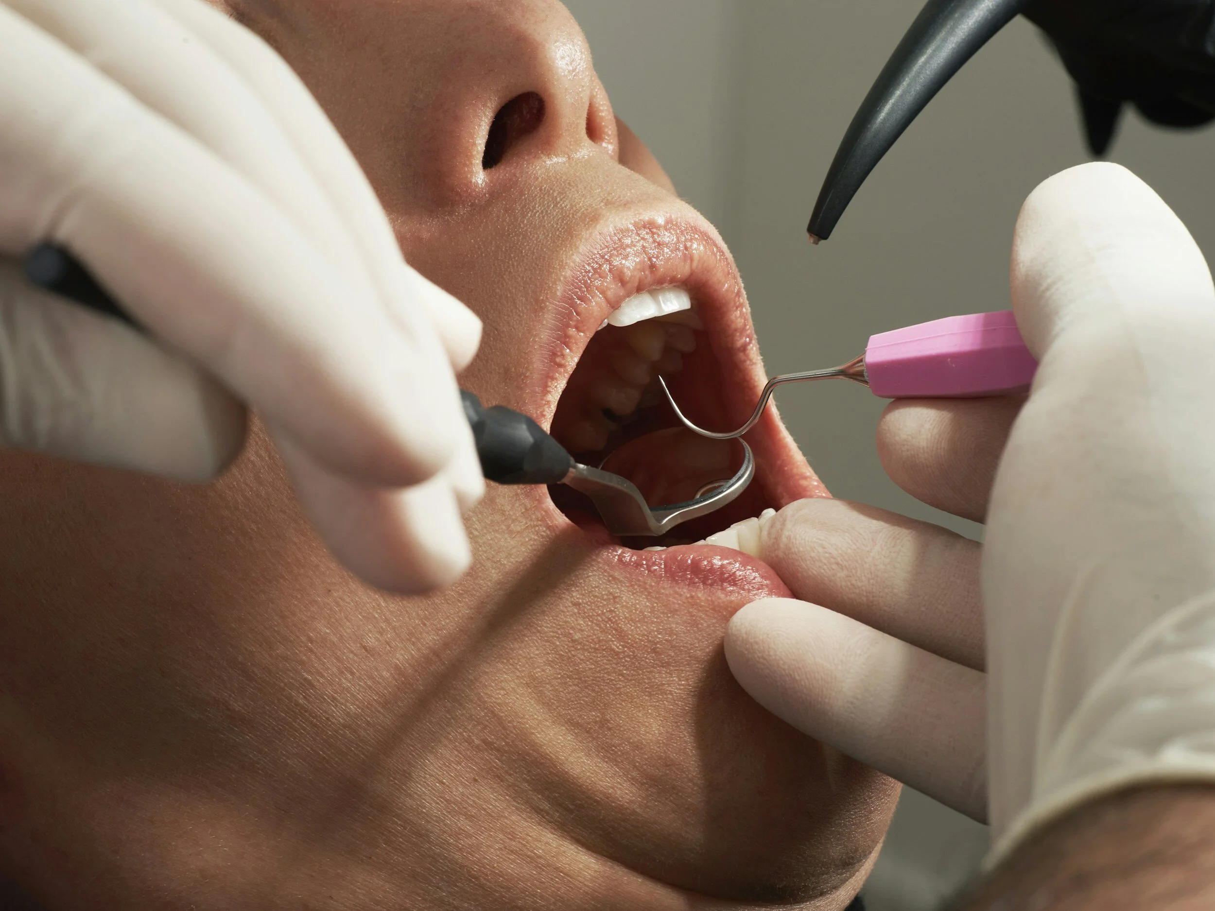 Should You Choose A Family Dentist Or A Generic Dentist?