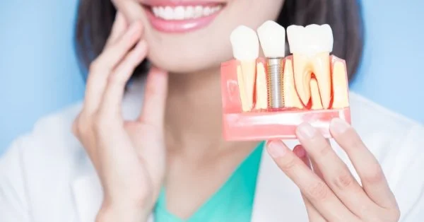ABA Implant - Is It the Best Implant?