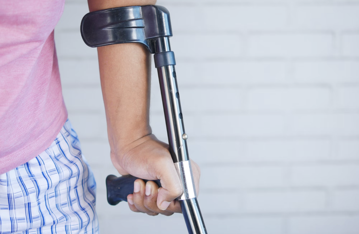 A Legal Overview to Follow When Dealing With a Serious Injury