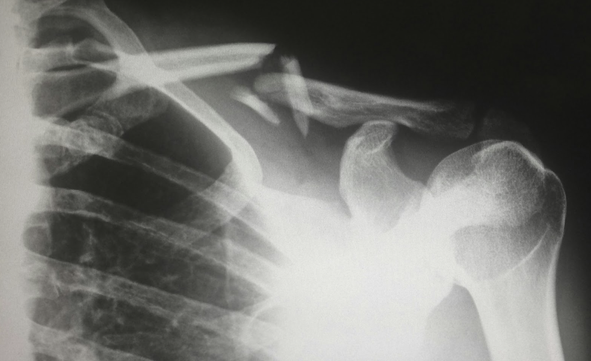 The Connection Between Injury Recovery and Overall Health