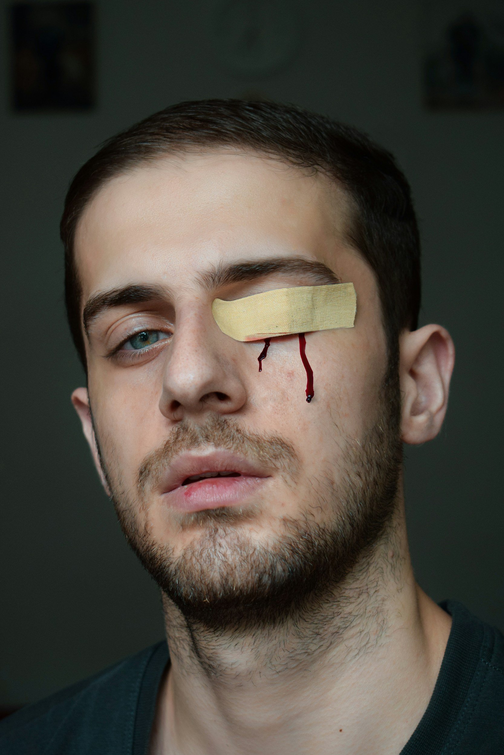 Timely Action in Personal Injury Cases