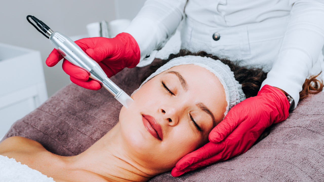 The Top 3 Ways in Which Microneedling Could Improve the Appearance of Your Skin