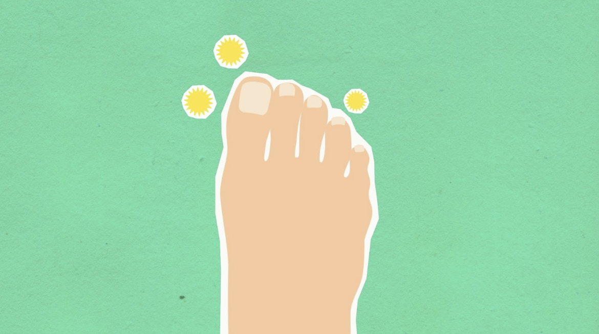 Natural Vs. Pharmaceutical Fungal Nail Treatments: What’s Best For Australians? 
