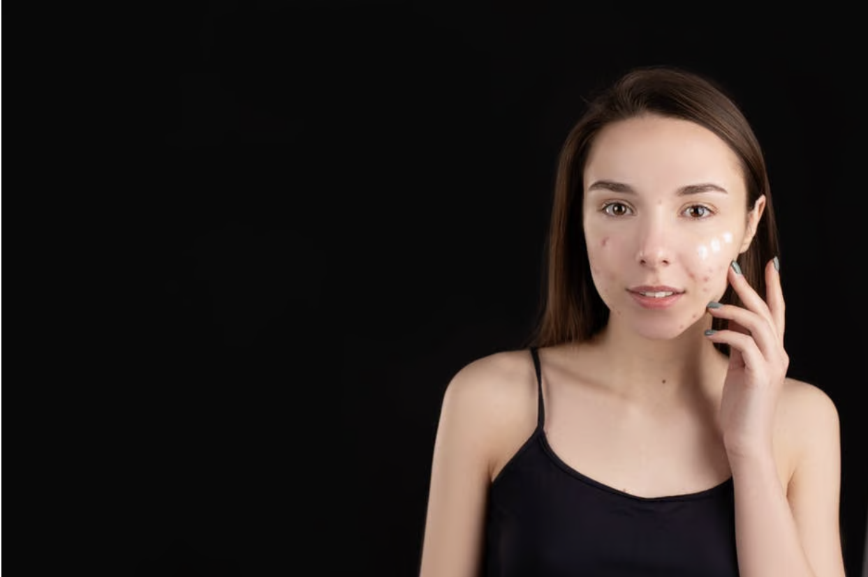 Common Skin Concerns and What to Do About Them