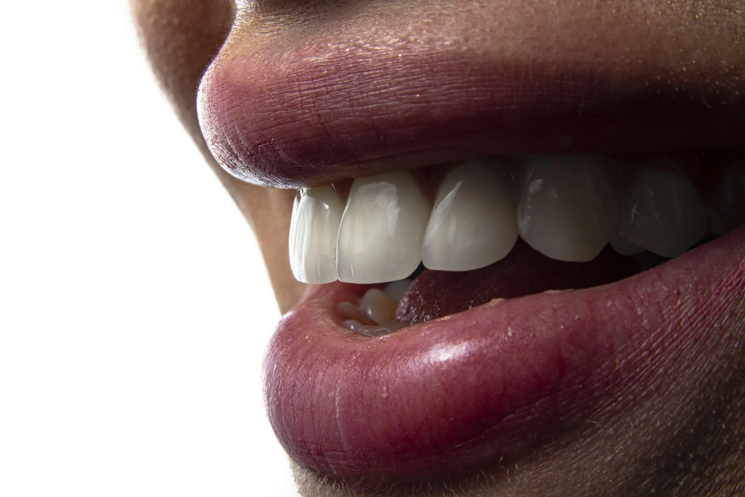 Inside Today’s Most Profitable Add-On Treatments for Oral Hygiene Teams