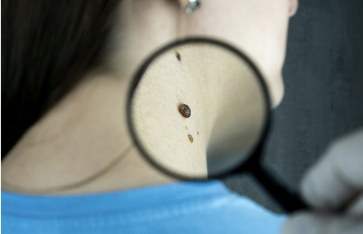 Smart Technologies Shaping the Future of Dermatology Equipment