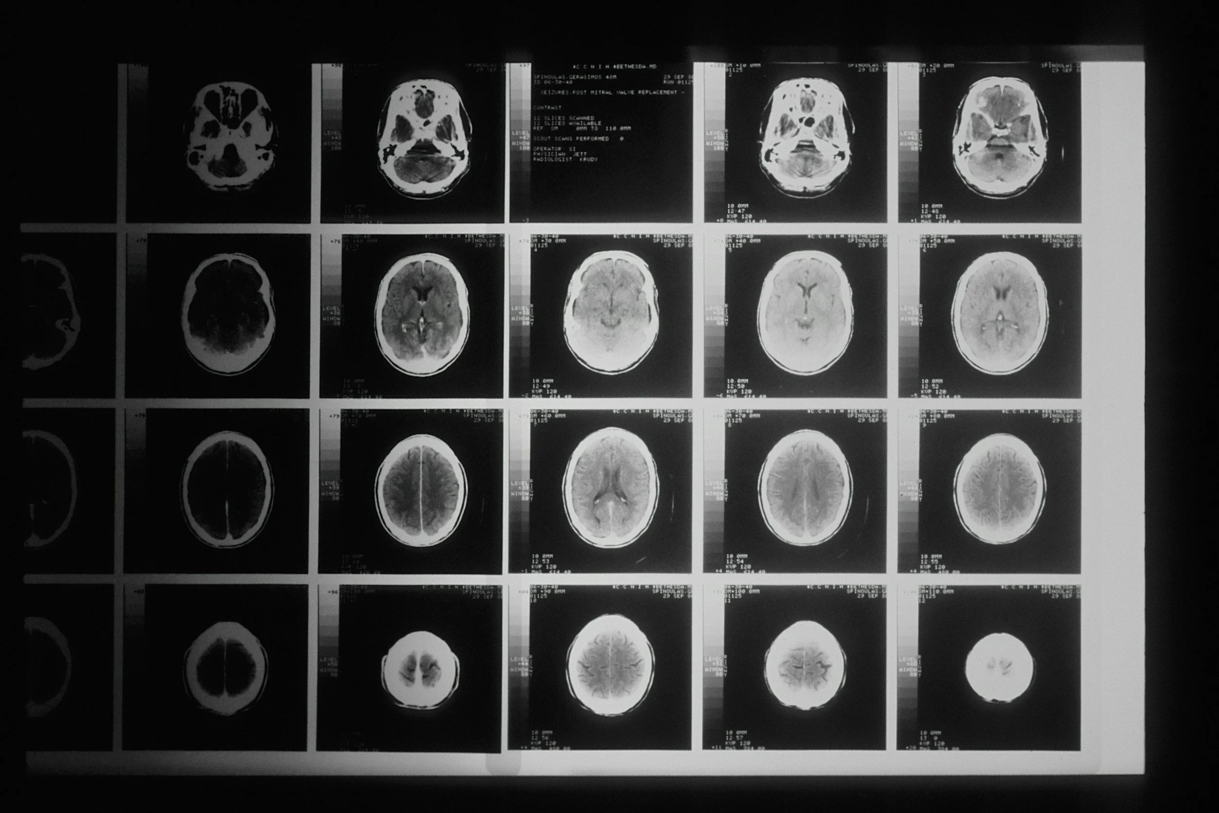 How X-Rays Protect Your Health