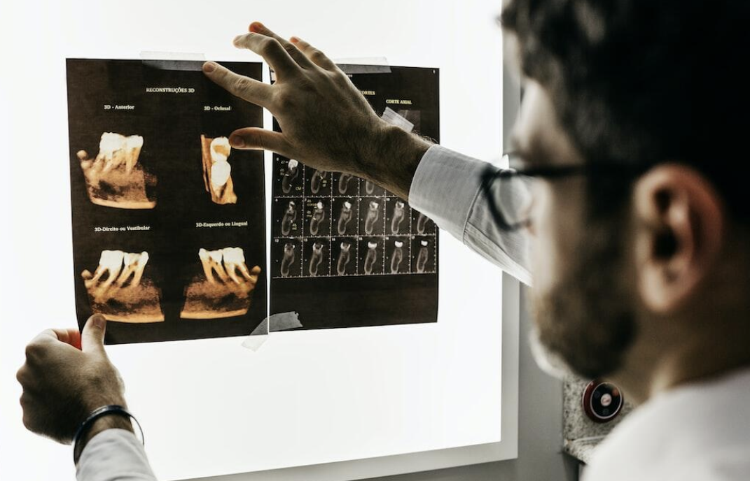 What to Expect Before and After a Tooth Extraction