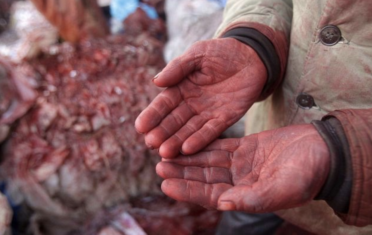 Dye stained hands of a garment worker . Photo: Daily Mail / AFP / Getty