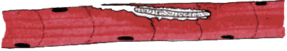 Step 4