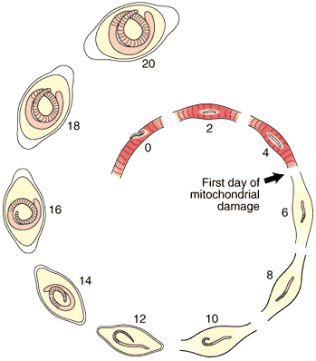 Mitochondrial Damage