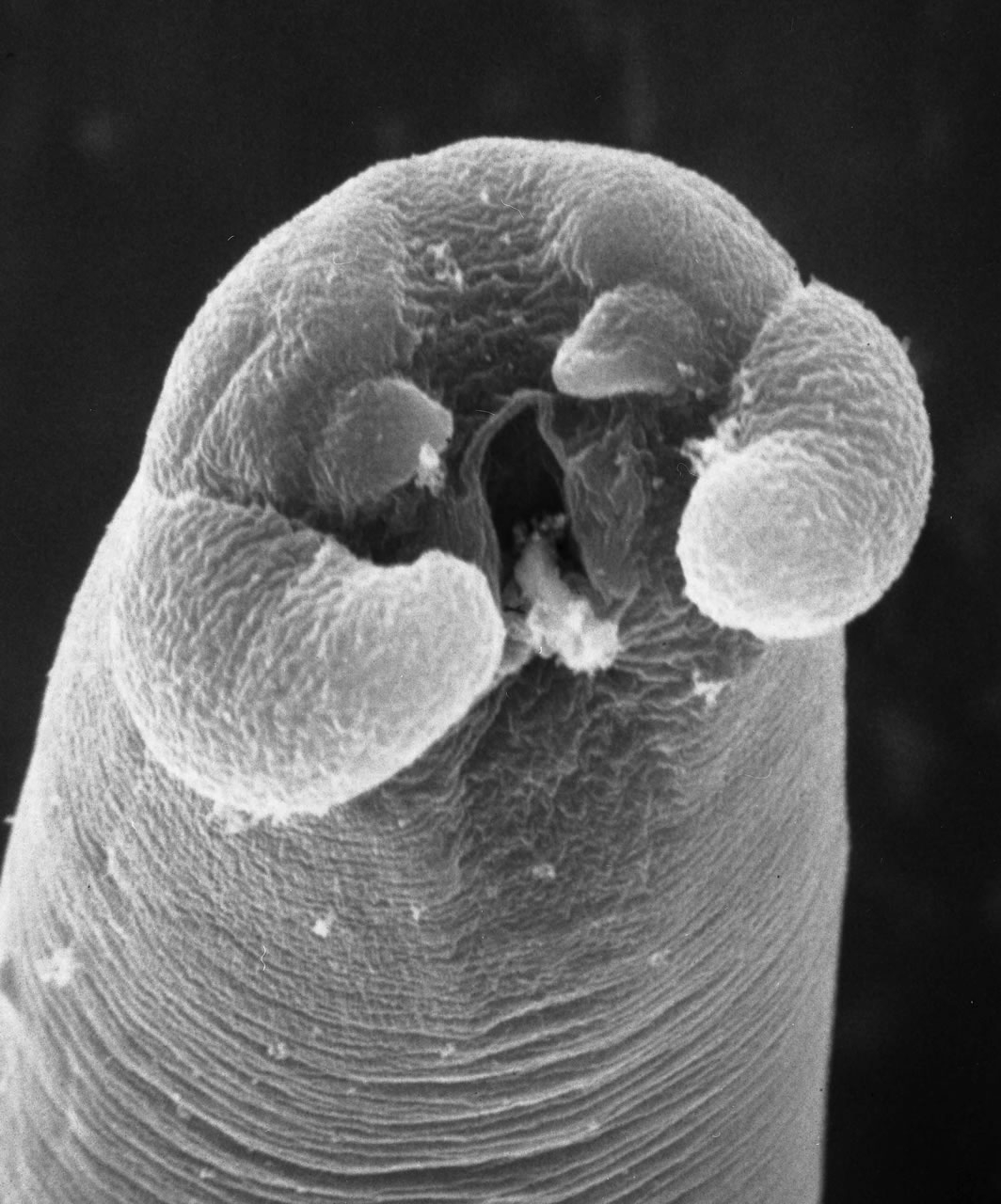 A trichinella hőmérsékleten meghal fájdalom és égő pinworms