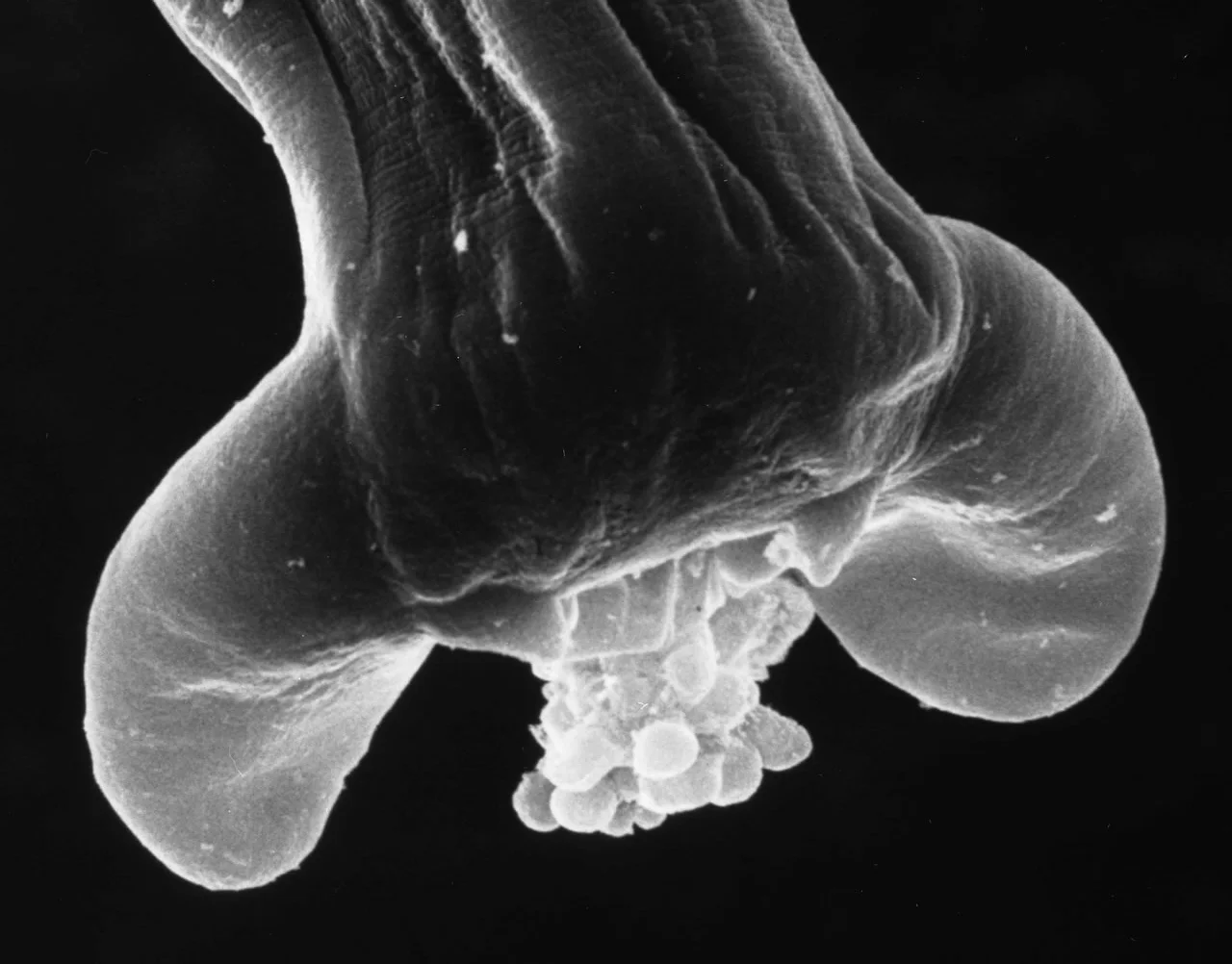Adult Male with extruded copulatory bell SEM